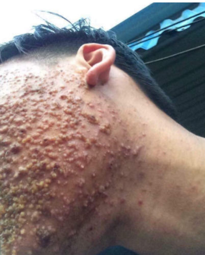 【シンガポール人？】イギリスのイケメン中国人、「コロナウイルス出ていけ」と顔の形が変わるまでブン殴られる
