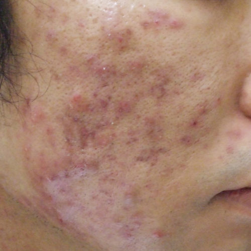【シンガポール人？】イギリスのイケメン中国人、「コロナウイルス出ていけ」と顔の形が変わるまでブン殴られる